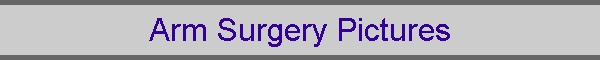 Arm Surgery Pictures